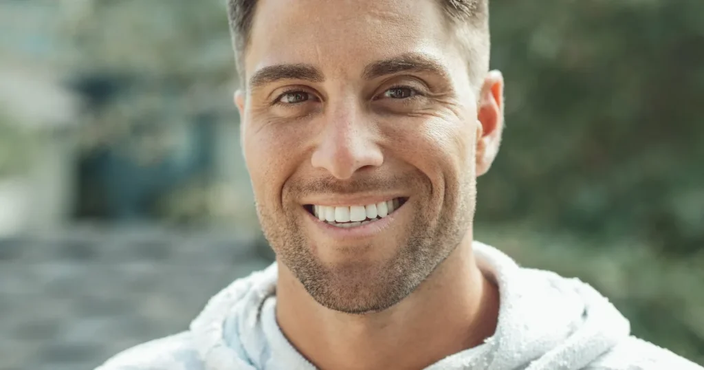 Man-Confident-Smile-Dental-Veneers